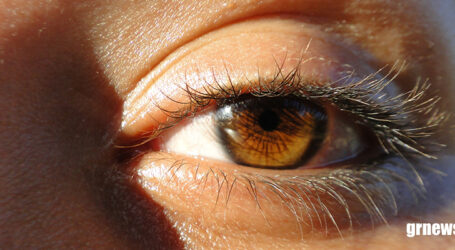 Olho preguiçoso pode ser causado por diferença de grau ou de erro refrativo entre os olhos
