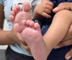 MG assume liderança nacional com teste do pezinho que identifica 64 doenças