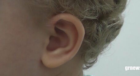 Ãh? Repete o que você falou? Saiba como identificar os primeiros sinais de perda auditiva