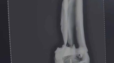 GRNEWS TV: Fragmento compatível com a face direita da imagem original de Nossa Senhora Aparecida fortalece elo com réplica em Pará de Minas