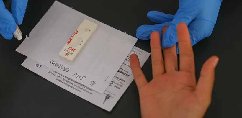 Brasil pressiona por nova PrEP de longa duração e transferência de tecnologia contra HIV/Aids